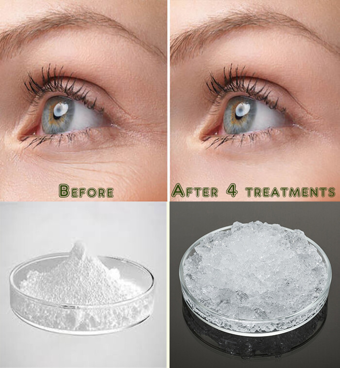 Pure Hyaluronic Acid Powder Sodium Hyaluronate for AntiAging Wrinkle Joint Serum
