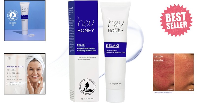 Oil-Free Hydrating Cream for Sensitive Skin - Instant Relief for Rosacea, 2.2 Oz gallery