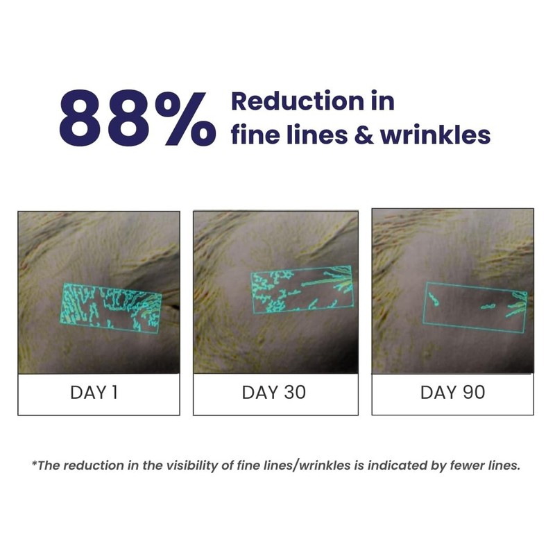 Retinol night cream for Anti-Aging, Wrinkles, Fine Lines & Skin Firmness - 32g gallery