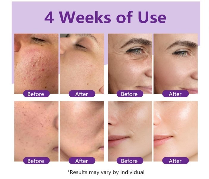 Encapsulated Retinol Serum for Pores & Smooth Looking Skin 30ml gallery