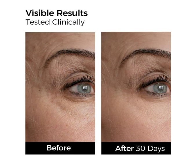 Collagen Serum 10 Vials Anti Aging Firming Hyaluronic Acid Repair gallery