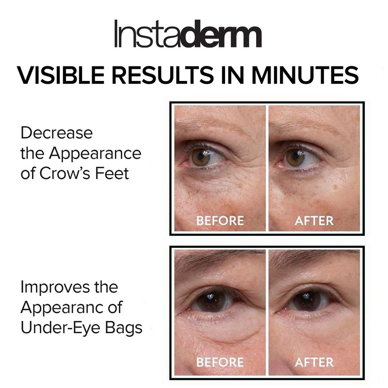 Instant Puffy Eye & Lift Treatment – Removes Under Eye Bags & Puffiness. gallery