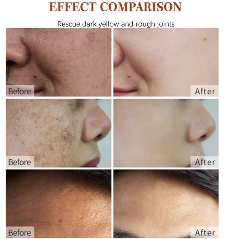 Dark Spot Corrector Face Neck Skin Dark Spot Remover Cream 45% Active Pigment gallery