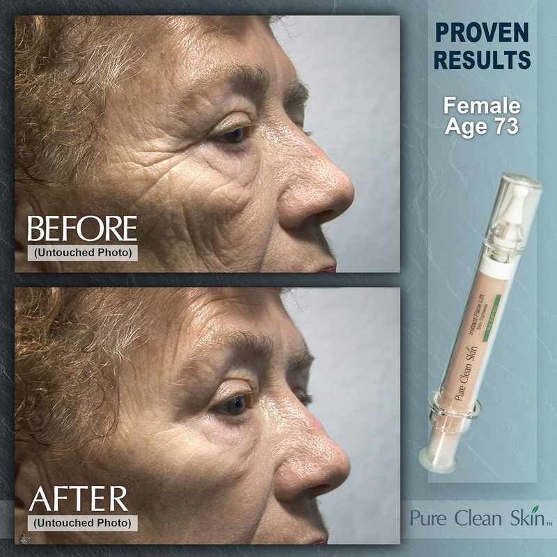 Eye Wrinkle Cream for Instant Lift & Firmness - Quick Results in 3-5 Minutes gallery