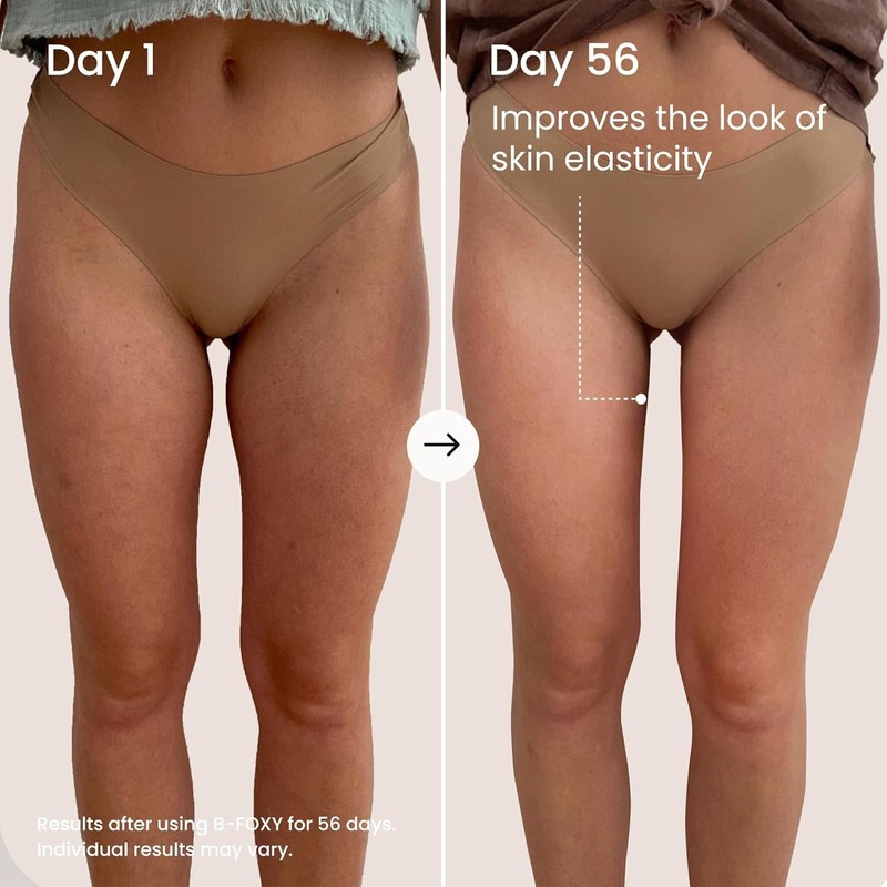 B-FOXY Inner Thigh Firming Cream - Skin Tightening and Firming for Women - Wi... gallery