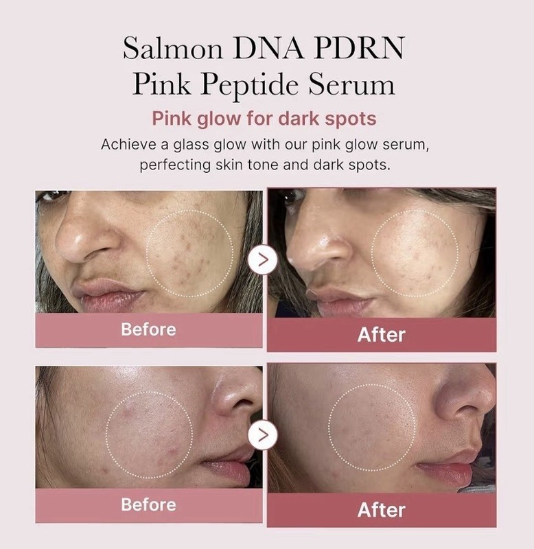 Medicube PDRN Pink Peptide Serum 1.01 fl oz– SALMON DNA | Anti-Aging Care 1/2PCS gallery
