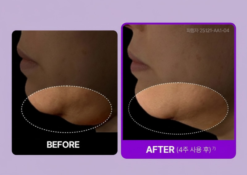 2 PACKS! Centellian24 Madeca Cream Tight Lifting - Anti-aging - No1. KR Skincare gallery