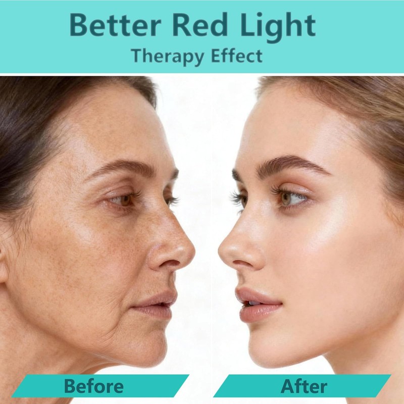 Red Light Therapy Activation Serum - Advanced Formula to Boost Collagen, Incr... gallery