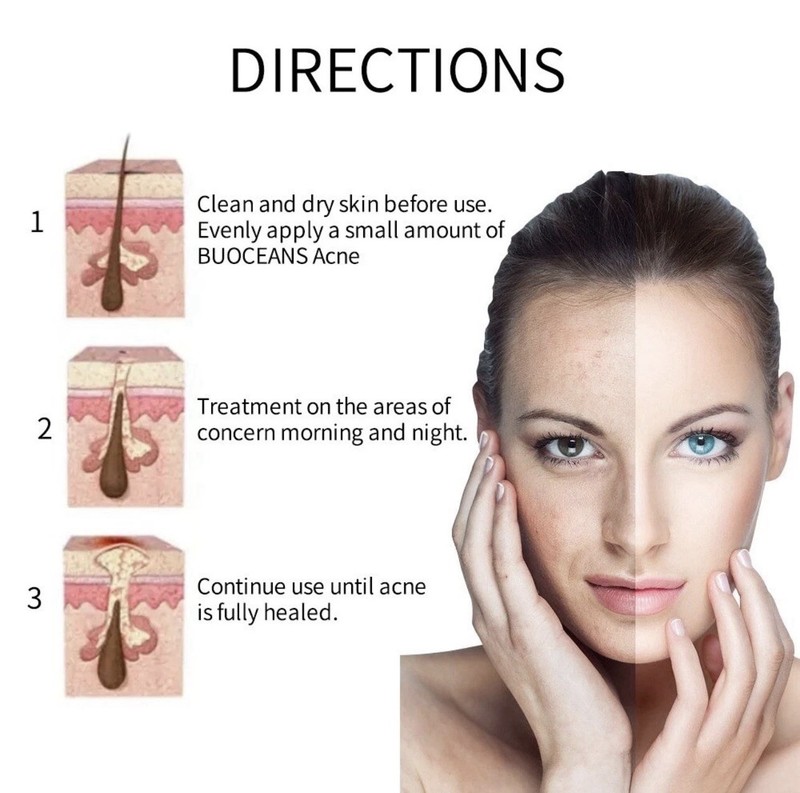 Dark Spot Corrector Face Neck Skin Dark Spot Remover Cream 45% Active Pigment gallery
