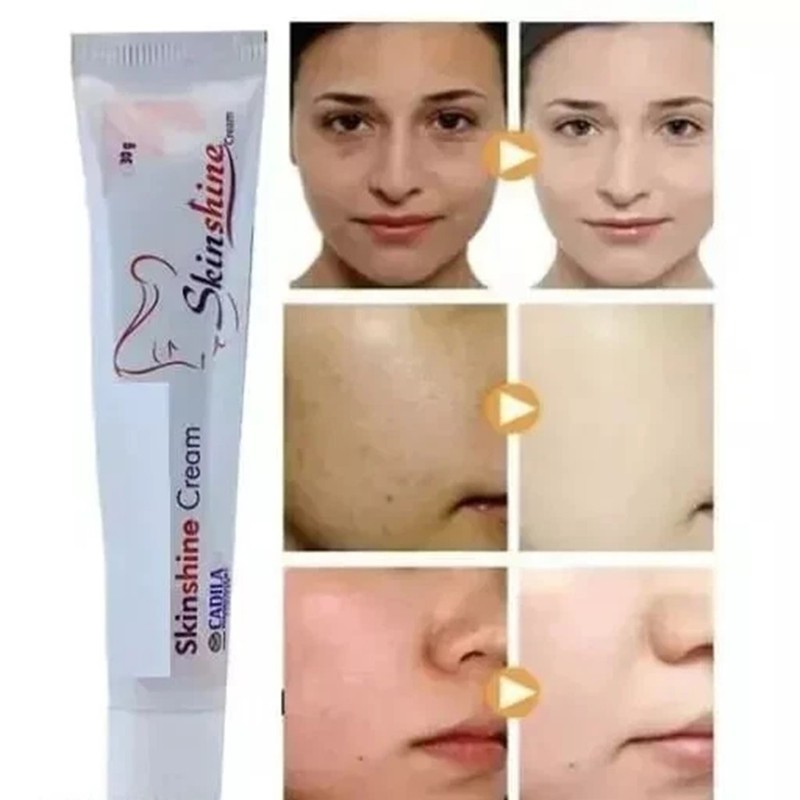 Up to 6x Skin Shine Cream 15g Skin Renewal For Redness Melasma Acne Skin gallery