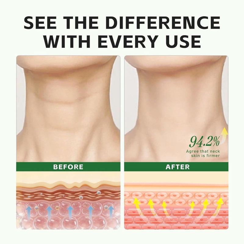 Retinol Neck Cream - Advanced Neck Firming Cream with AH8 for Crepey Skin, Hyalu gallery