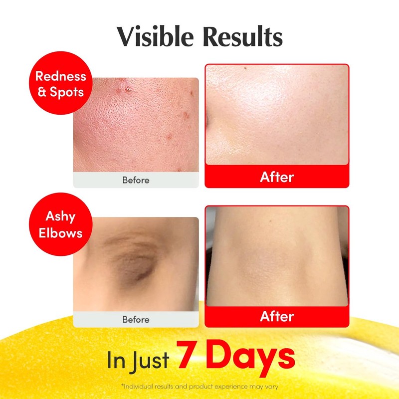 Vitamin Illuminating Serum Niacinamide 4% Brightening Vitamin C 1.01 fl.oz gallery