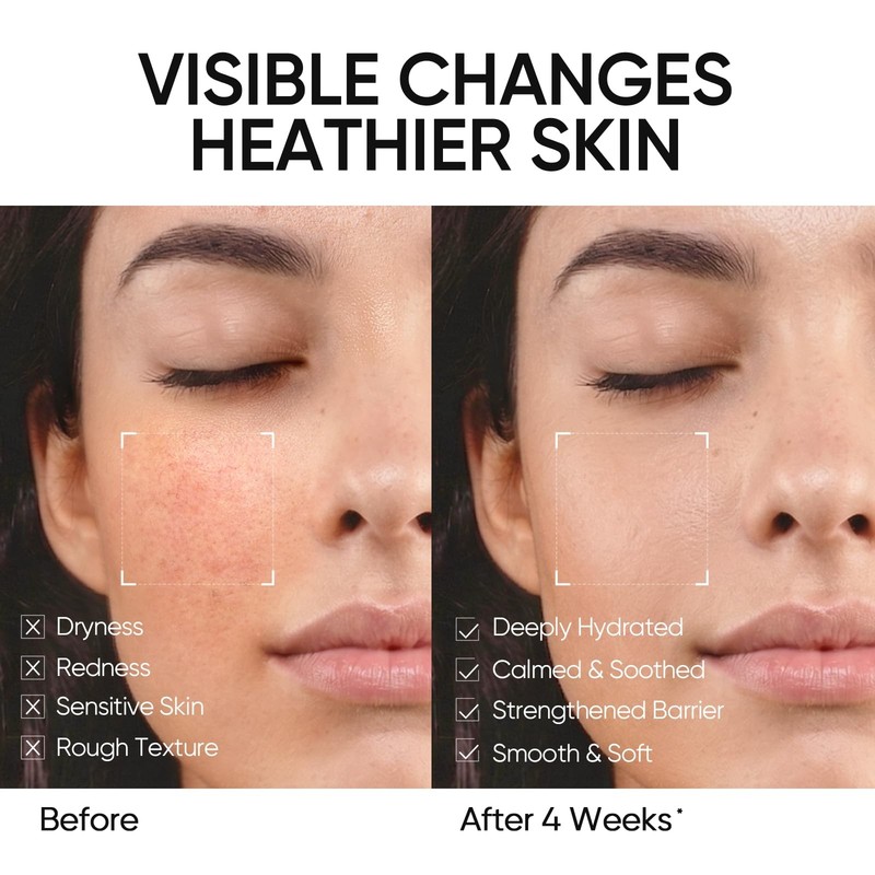 Face Moisturizer with 5X Ceramides, Hydrating Moisture Barrier Repair Cream f... gallery