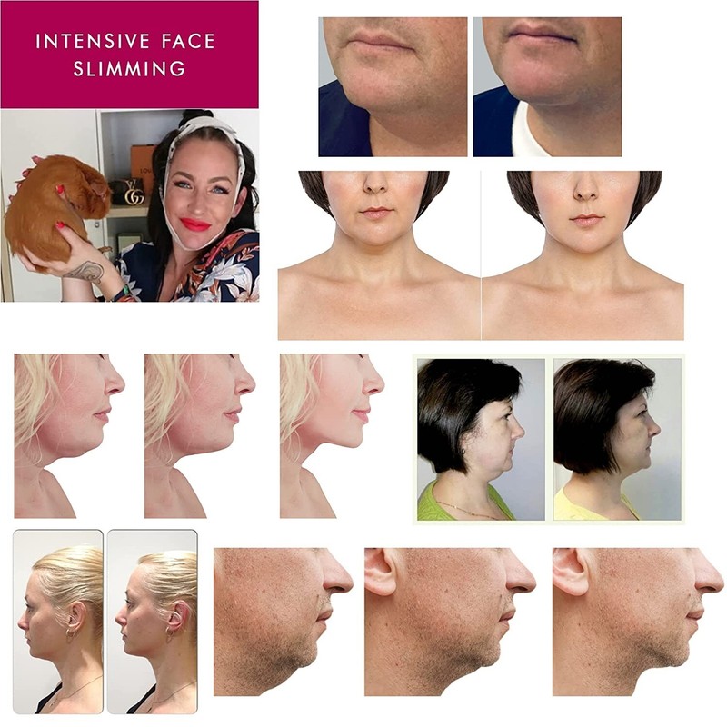 Face Lift Double Chin Reducing Cheek Slimming Neck Firming Masks and Cream gallery