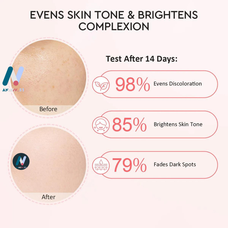 GLAD2GLOW 10% Niacinamide Brightening Serum Acne Scars Dark Spot Anti-Aging 17ml gallery