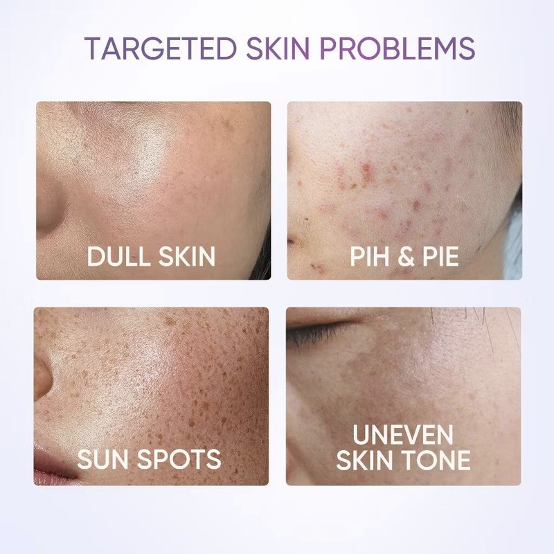 SKINTIFIC Dark Spot Moisture Gel SYMWHITE 377 Brightening Acne Scar Aging Skin gallery