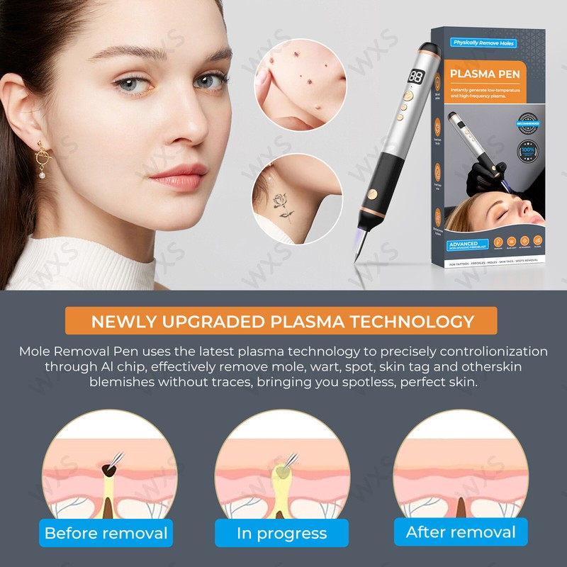 Skin Tag Remover - Skin Tag and Mole Remover for Home Use, Portable Removal Kit gallery