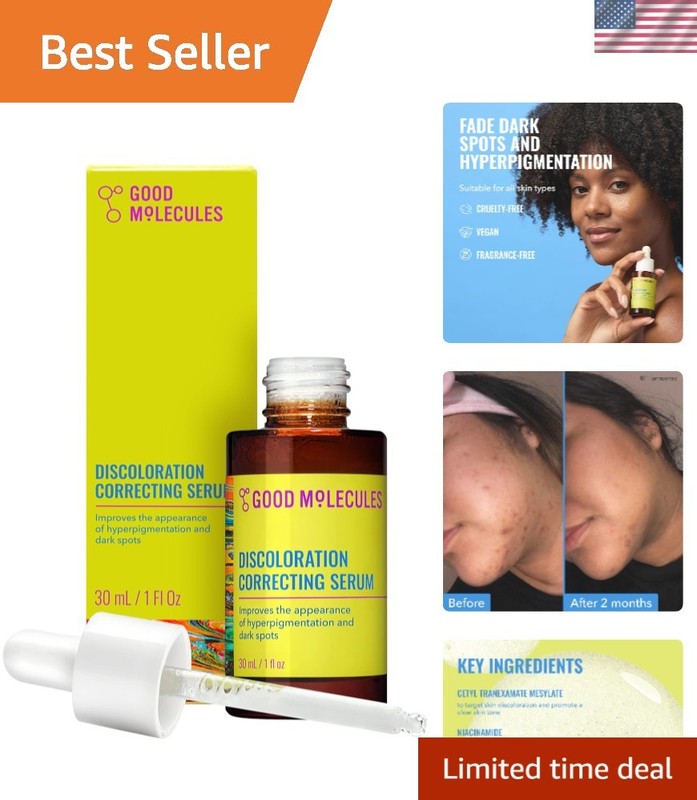 Gentle Brightening Serum for All Skin Types – Targets Hyperpigmentation 1 FL OZ