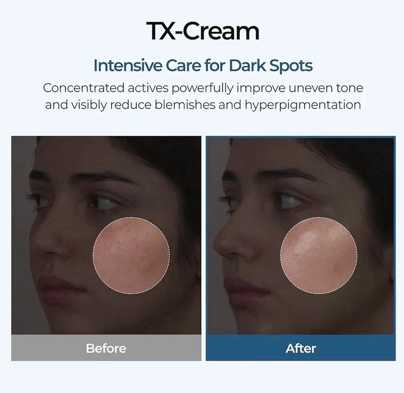 Dr. Melaxin TX Cream with Tranexamic Acid + Niacinamide 50ml gallery