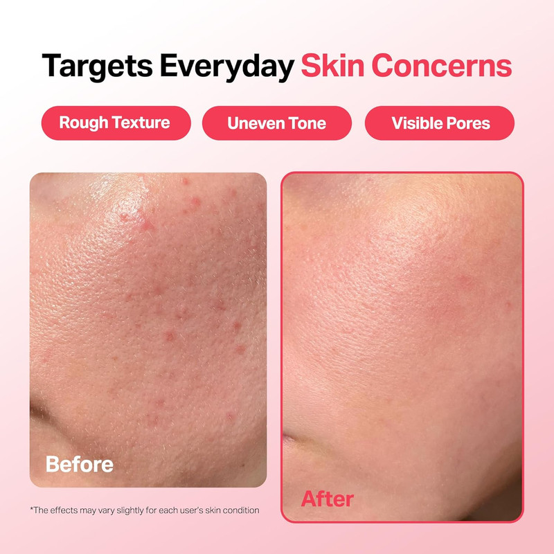 Camellia Clear Daily Exfoliating Serum – 2% Niacinamide + AHA & PHA, Gentle Chem gallery