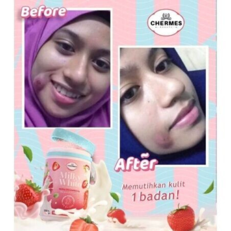 x4 K-Colly Chermes MilkyWhite Collagen 500g Strawberry Whitening Skin Supplement gallery