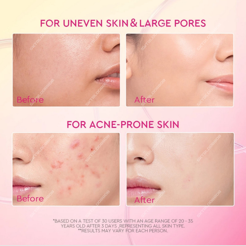 Glad2glow Peach Retinol Moisturizers Brightens Skin Free Shipping gallery