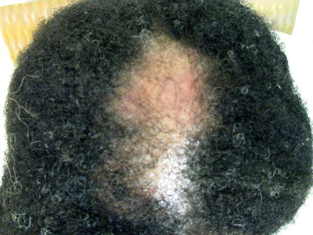heart health diet - DHT BLOCKER HAIR FORMULA - verified hair growth support 2BOT gallery