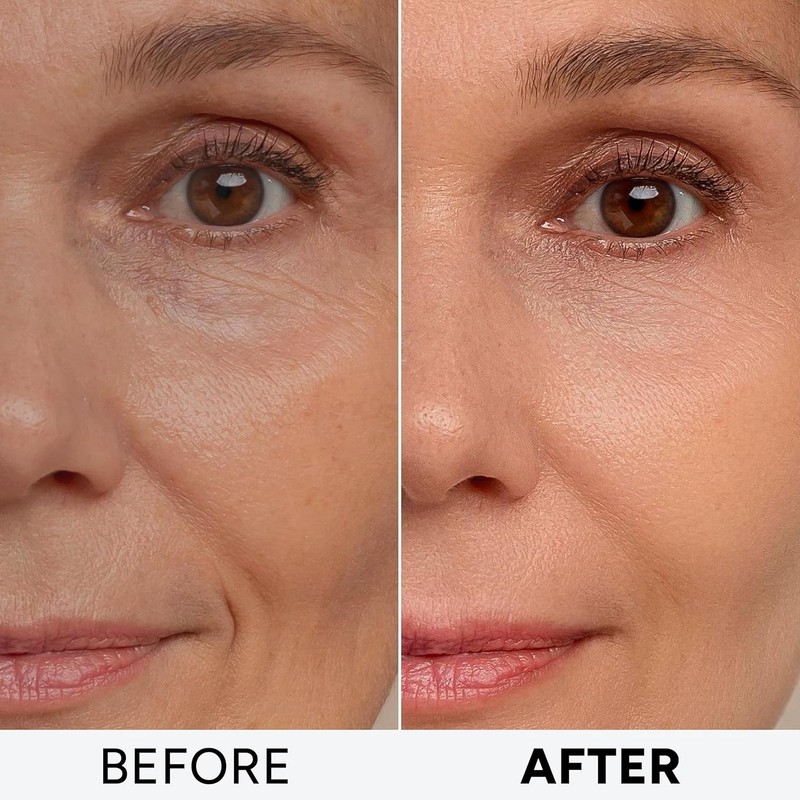 "Crema Para Las Arrugas Tratamiento De La Cara Colageno Mujer ⭐️⭐️⭐️⭐️⭐️ " gallery
