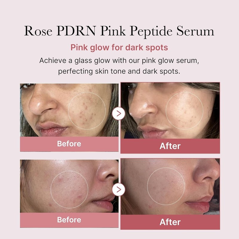 medicube PDRN Pink Peptide Serum 1.01oz | Glow, Firming, Hydrating, Korean Skin gallery