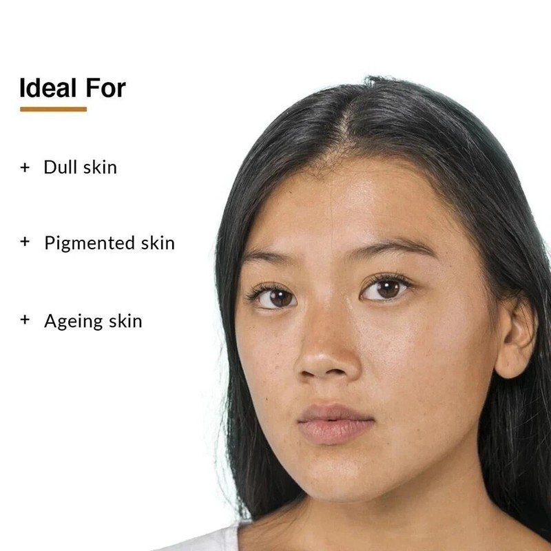 Fixderma 17% Vitamin C Face Serum Niacinamide Serum - 15g gallery