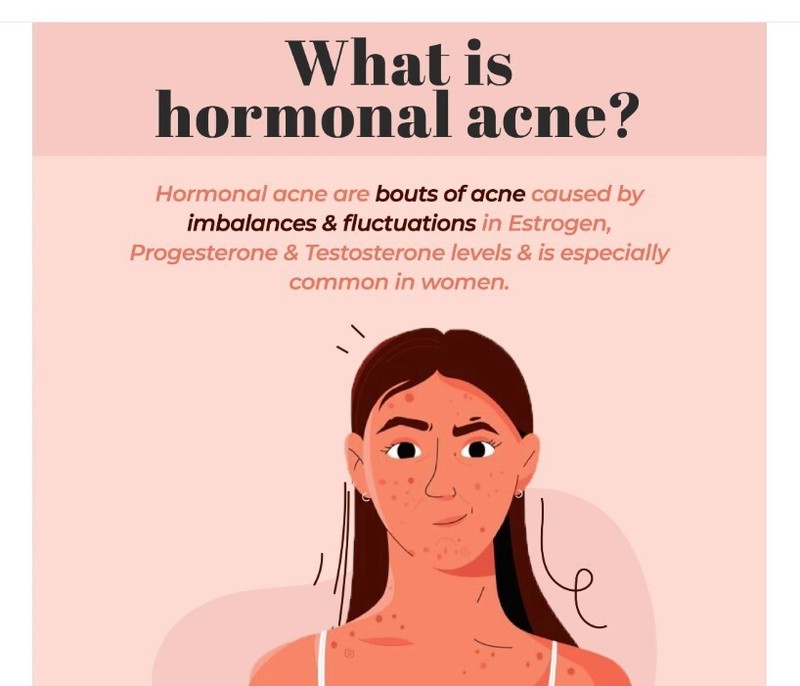 NATURAL HELP FOR ACNE HORMONAL FOR WOMEN - 100% NATURAL HERBAL - MADE IN USA gallery