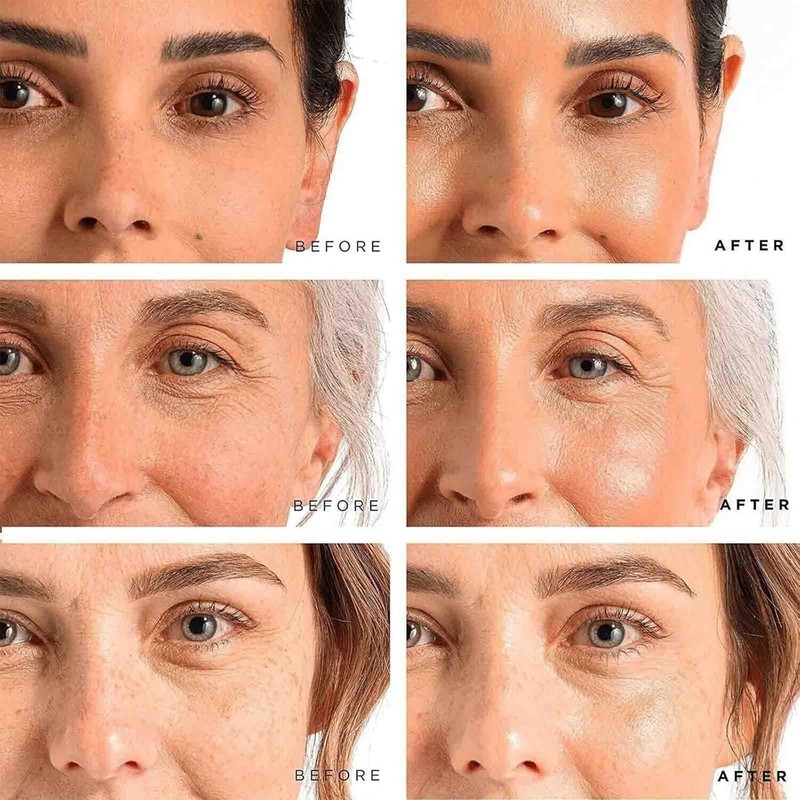 Age Barrier Advanced Face Cream - Skin Barrier Repair & Interrupter Age, Anti... gallery