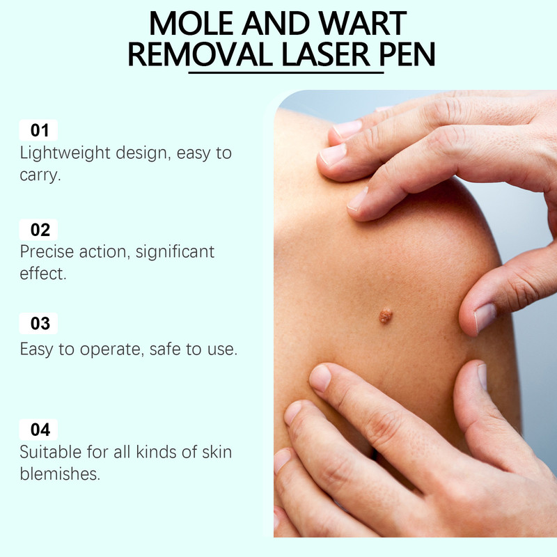 Electric Laser Plasma Pen Mole Removal Dark Spot Remover Skin Wart Tag Remover gallery